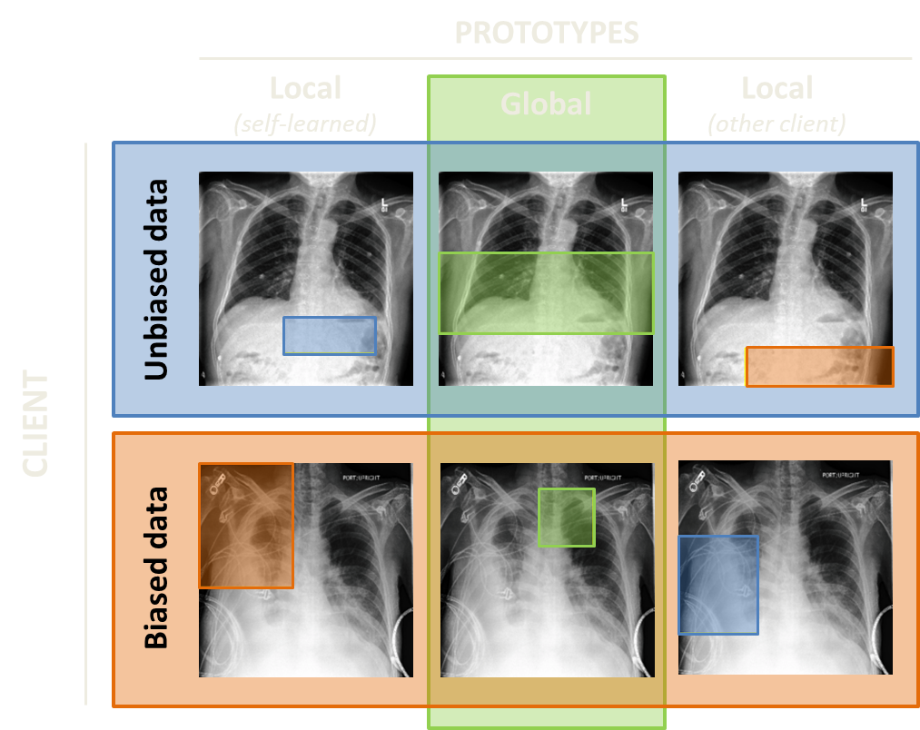 prototypes_pleural